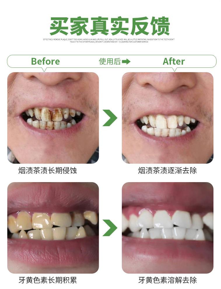 去牙渍牙垢祛黑牙洗白粉牙齿速效洗牙粉非去抖音同款