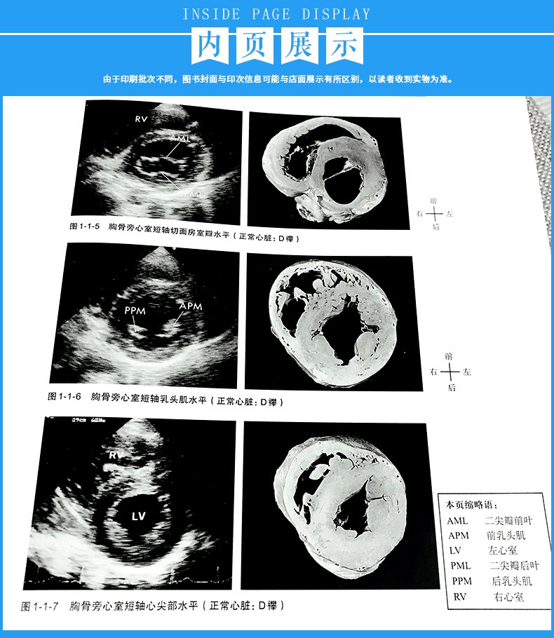 正版 先天性心脏病超声精细讲解 切面解剖.
