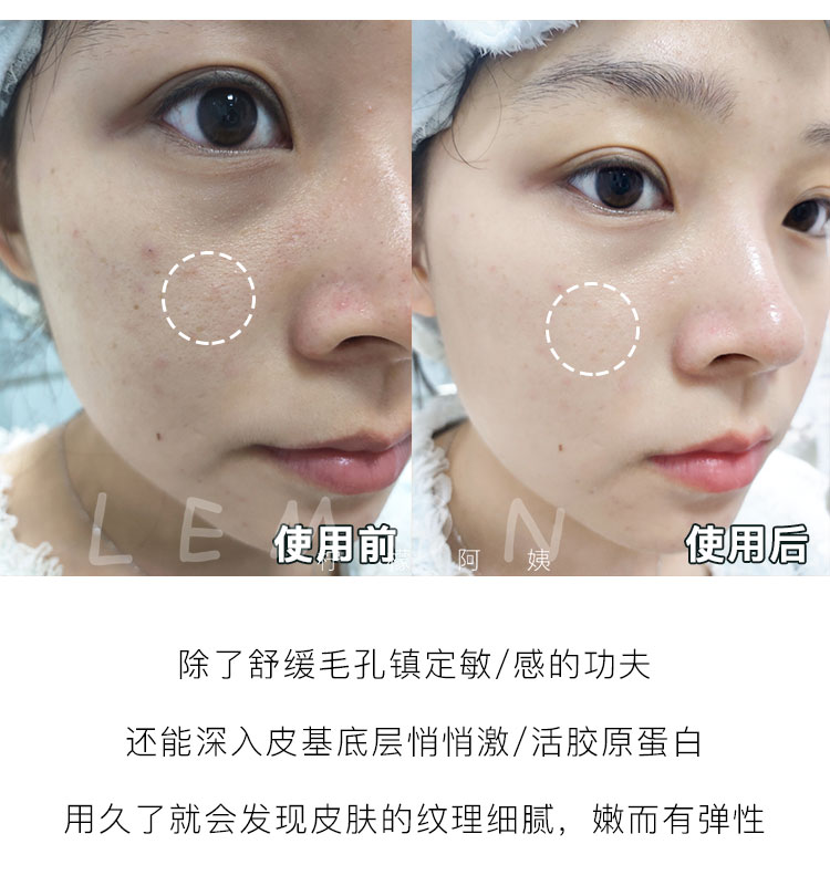 一秒焕活 韩国麻芢膏麻仁膏面膜涂抹式焕采补水滋润保湿提亮女