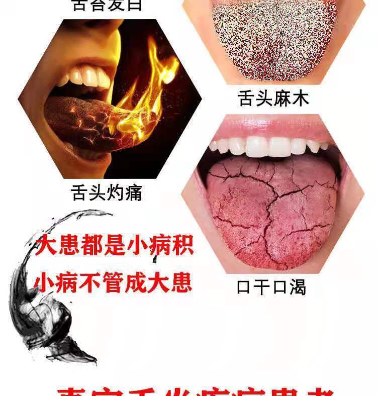 舌乳头炎治疗图片