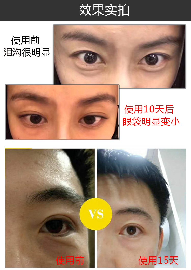 祛除泪沟眼去黑眼圈眼袋眼睛护理填充眼窝丰泪沟卧蚕精华男女