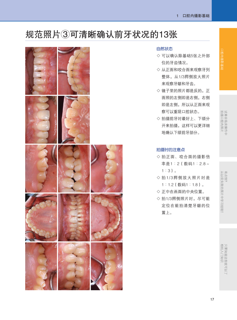 口腔全景片拍摄流程图片