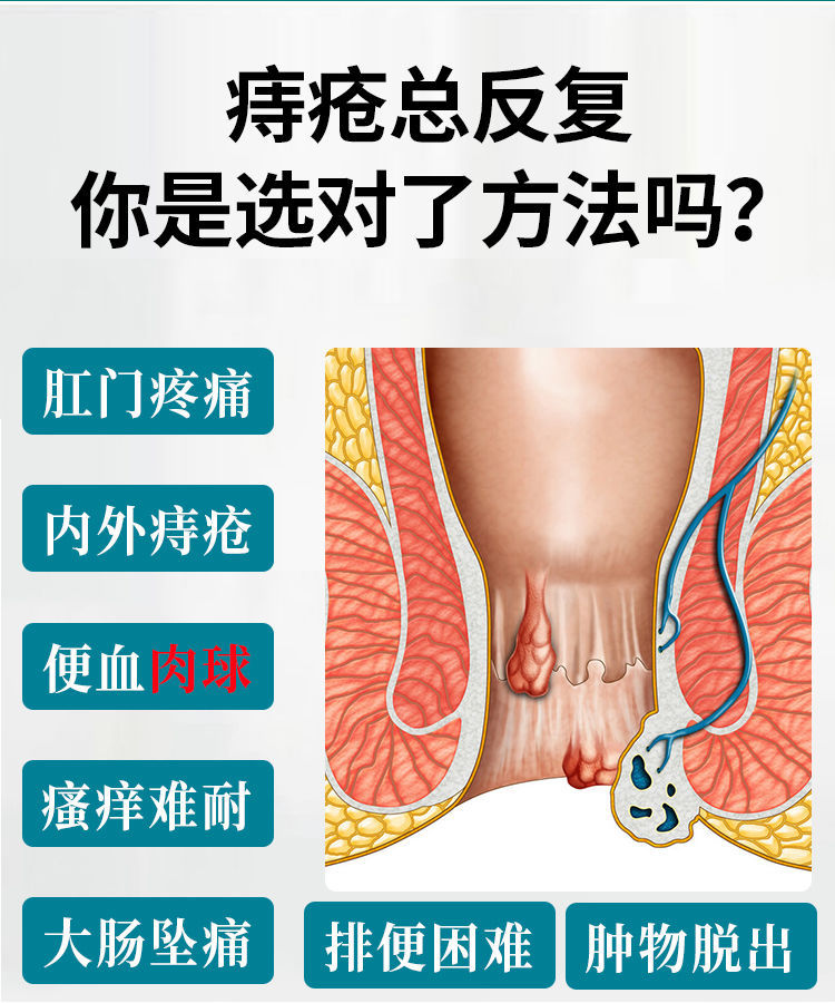 痔疮膏克星肛门肉球99成功落痔肛裂湿痒内痔外痔混合特效止痛体验装