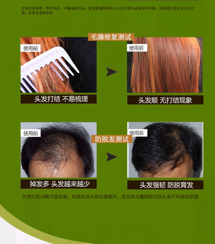 米雅诗防脱发洗发水浓密黑发滋润顺滑秀发增发止痒去屑养护发质