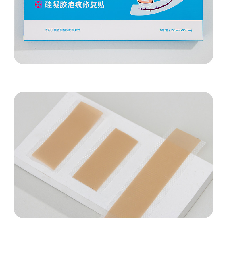 cvkk其它医用辅料3片/盒 cvkk疤痕贴150mm*30mm 3片/盒(dqt30 lbj50)