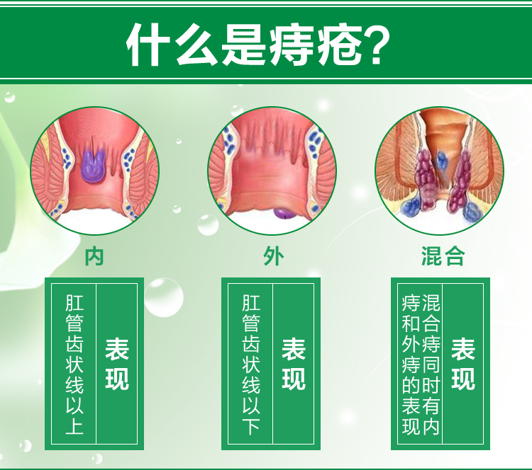 肖氏家方清芝乐肖润堂容肖清芝乐膏本膏内痔外痔混