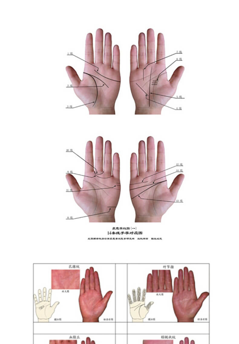 王晨霞掌纹图典掌纹图解手诊书诊病治病教程书籍黄晨霞看手相中医养生