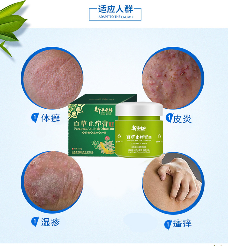 【买1送1无效可退】百止痒膏霜止痒药膏癣药膏成人慢性顽固湿疹过敏肛