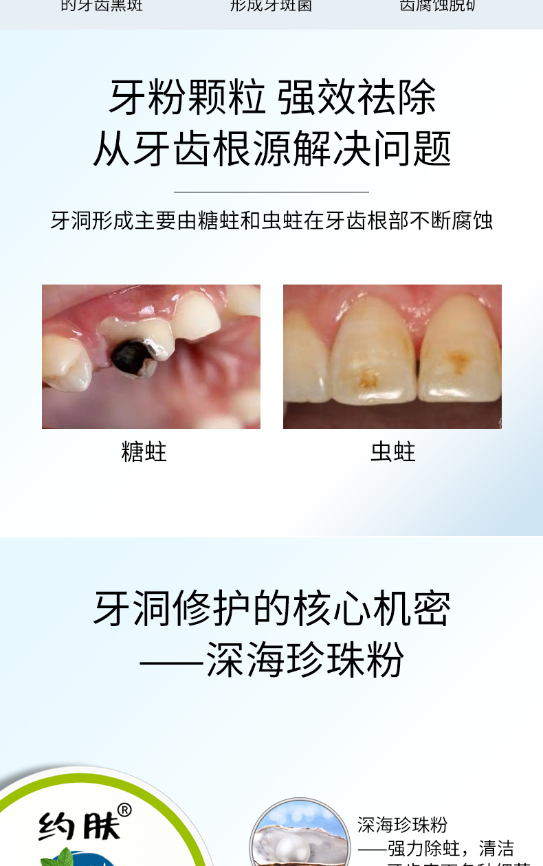 儿童洗牙粉蛀牙修复牙洞龋齿清理牙膏去虫牙菌斑祛除神器牙齿黑斑