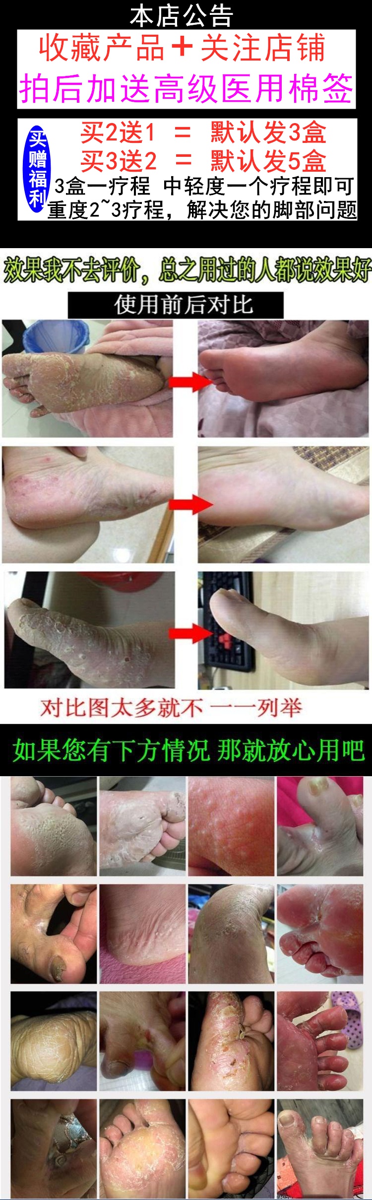 蓝尼芳可 Lnfk 护足霜q膏要烂脚丫脱皮糜烂水泡型止痒去除呿真菌感染脚痒喷剂膏要 价格图片品牌报价 苏宁易购创达豪美妆专营店 蓝尼芳可 Lnfk 护足霜q膏要烂脚丫脱皮糜烂水泡型止痒去除呿真菌感染脚痒喷剂膏要 价格图片品牌报价 苏宁易购创达豪美妆专营店