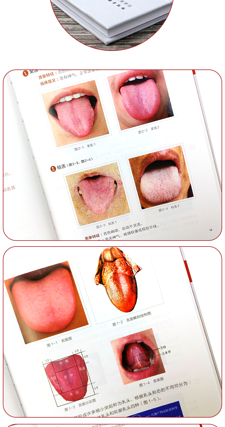 惠典正版中医舌诊临床图解中医望诊与舌诊彩色图解400余幅典型舌象图