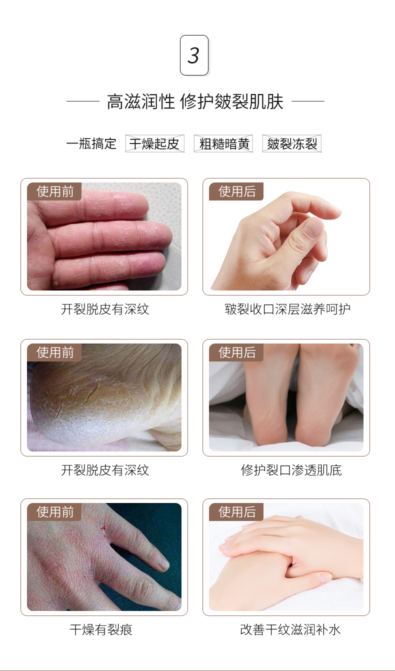 隆力奇手霜隆力奇 两瓶装 80g蛇油膏蛇油精华防冻防裂呵护手足深层滋润护手霜 价格图片品牌报价 苏宁易购隆力奇旗舰店