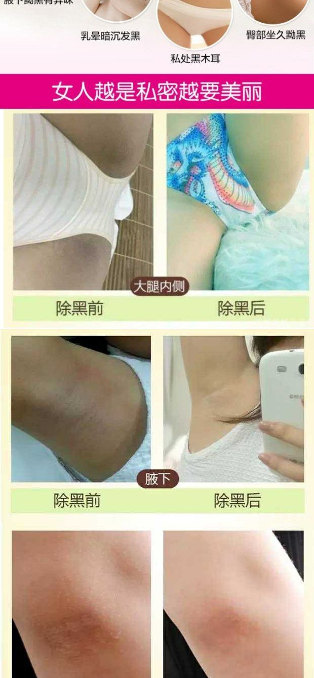 女人大腿中间内侧图片