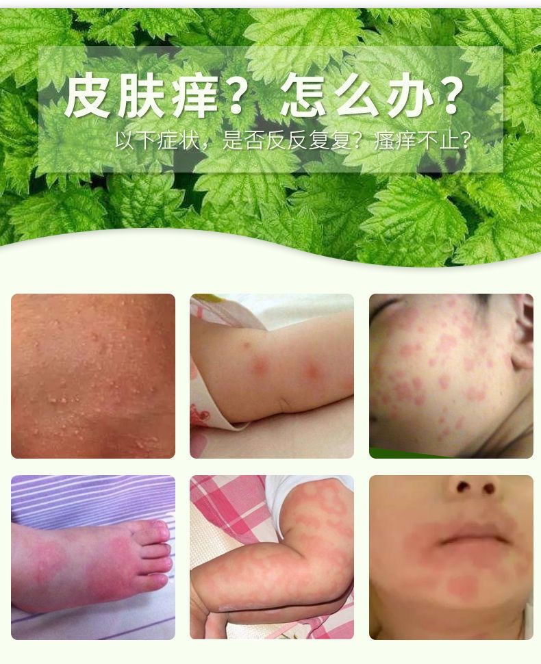 凤凰翎苗草王宝宝维肤膏15g湿疹护臀膏护肤霜特护膏婴宝1支巨亏跑量15