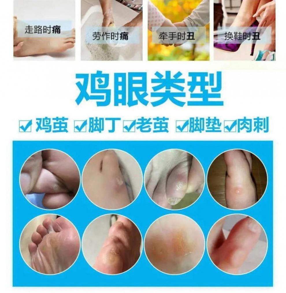 《修正鸡眼贴【一盒6贴】 鸡眼脚趾脚趾头鸡眼贴》无著【摘要 书评
