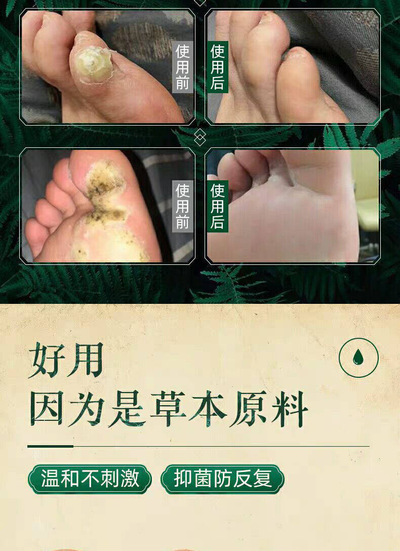 修正清茧灵脚茧消茧灵厚皮脚底老茧手茧祛去除茧子神器软化剂脚垫清茧