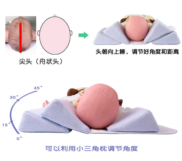喻娄婴儿定型枕宝宝纠正头型枕新生儿侧睡枕防偏头尖头扁平头01